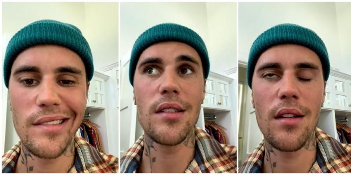 Justin Bieber muestra el "grave" virus que le provoca una parálisis parcial en el rostro