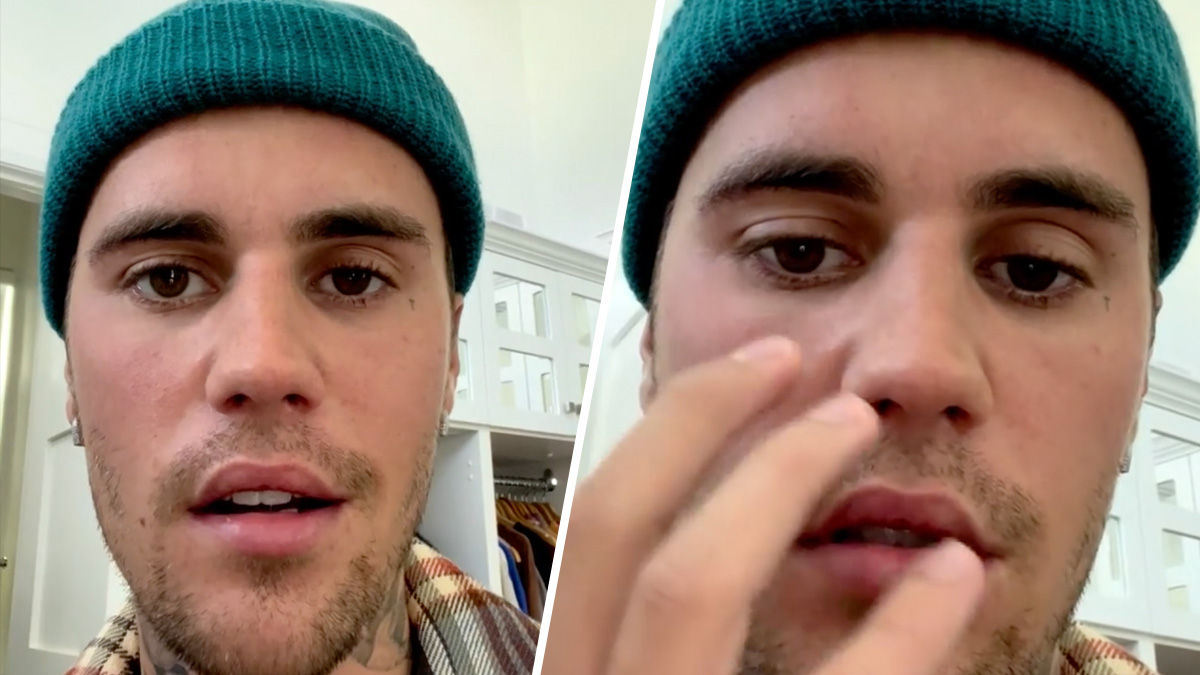 Justin Bieber revela que sufre parálisis facial por un virus y cancela conciertos