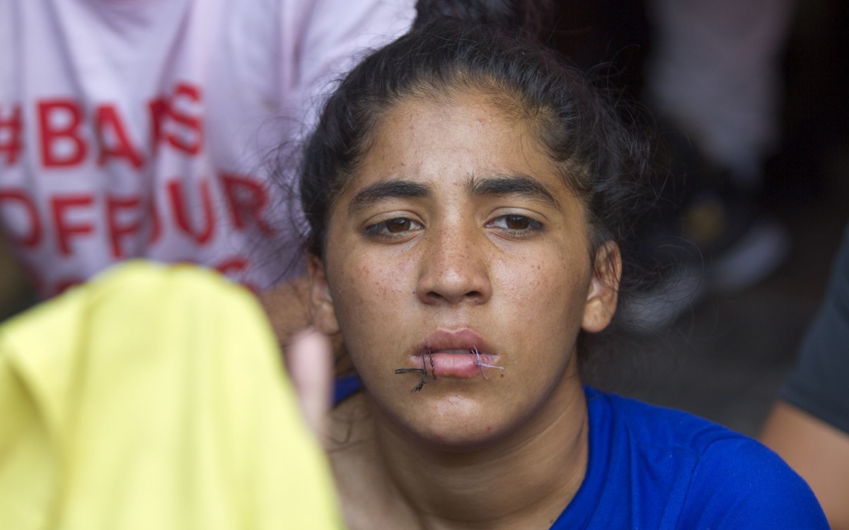 Migrantes se cosen los labios en protesta en Nuevo León | Fotos