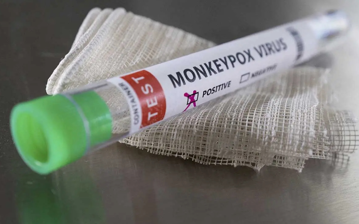 OPS: CDMX encabeza contagios de viruela del mono en México