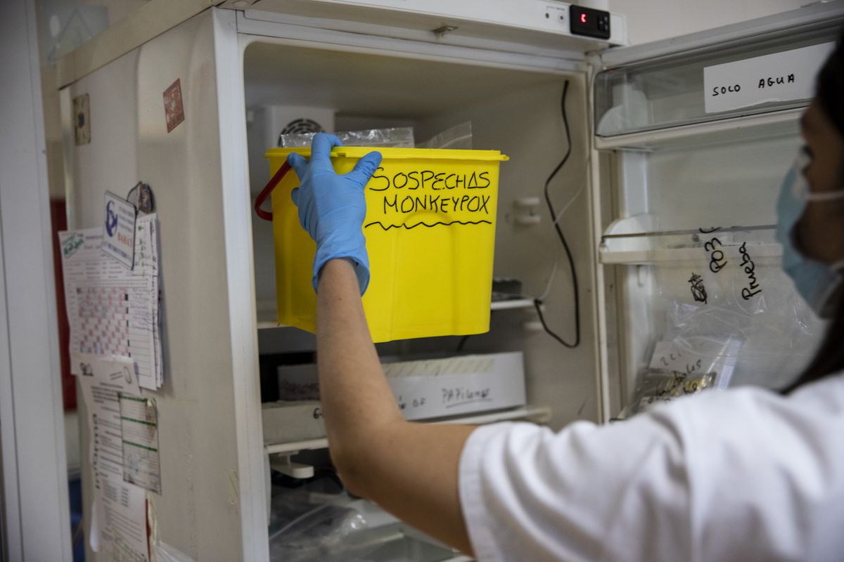 Un paciente con viruela del mono huye de un hospital en Jalisco y vuela a Estados Unidos