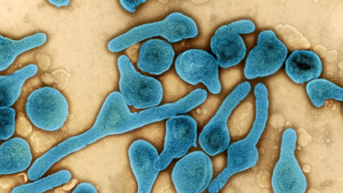 OMS informa de brote de virus de Marburgo que ya causó dos muertes en Ghana