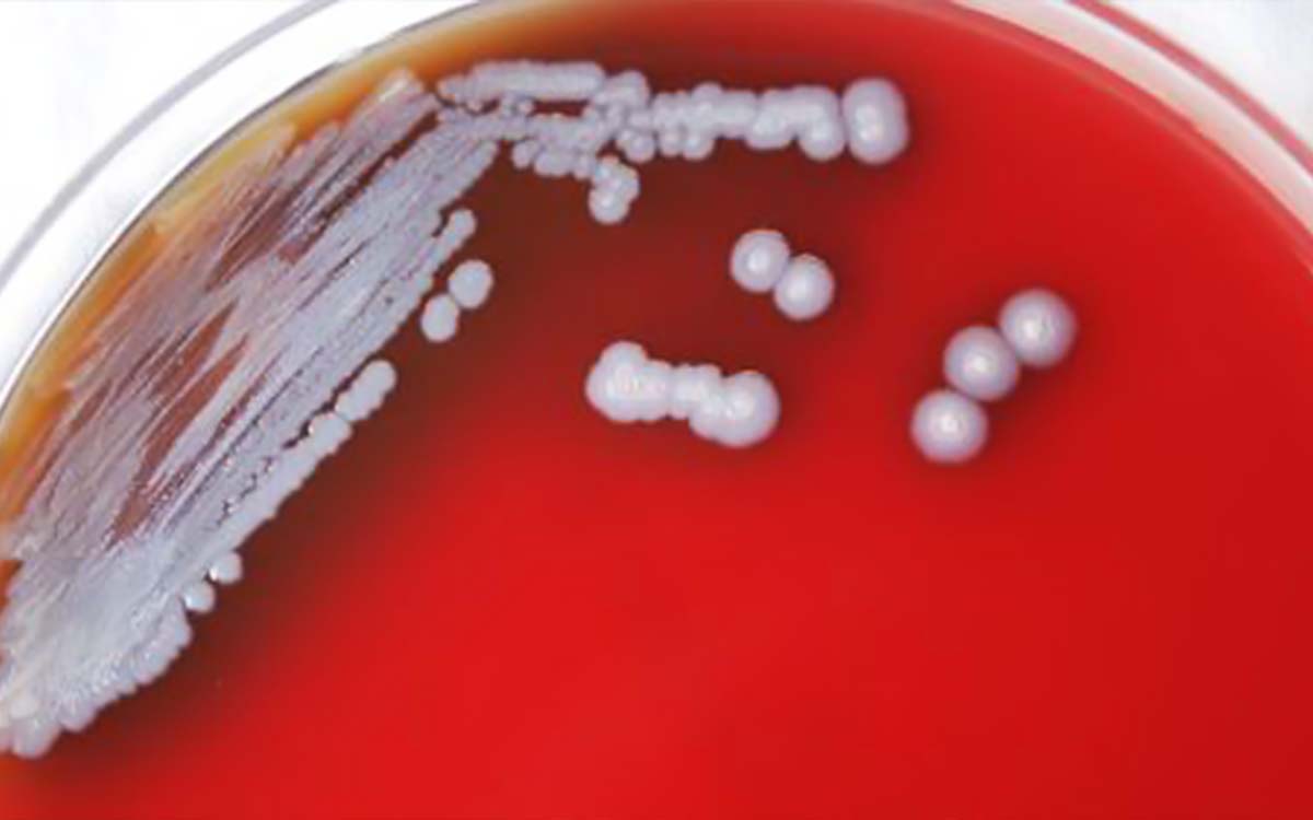 Detectan en EU bacteria que causa la rara y grave enfermedad melioidosis