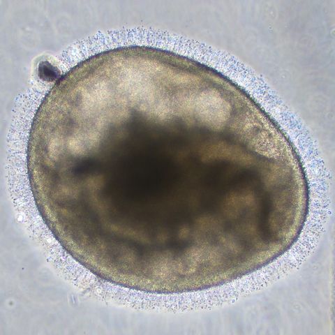imágenes microscópicas de los organoides retinianos con estructuras parecidas a pelos en los segmentos externos de la superficie