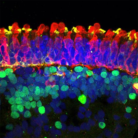 un organoide que muestra bastones y conos y otras células de la retina con diferentes marcadores fluorescentes