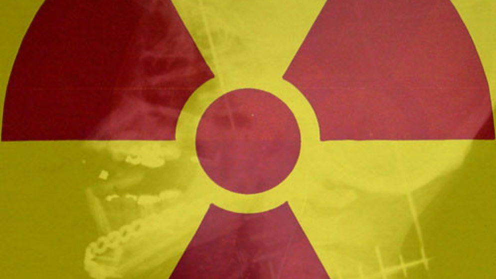 El radón un gas radiactivo dañino para la salud que vive en tu casa
