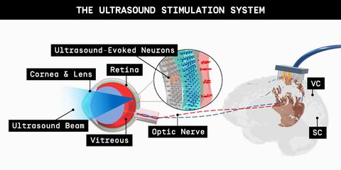 el sistema de estimulación por ultrasonidos para la visión