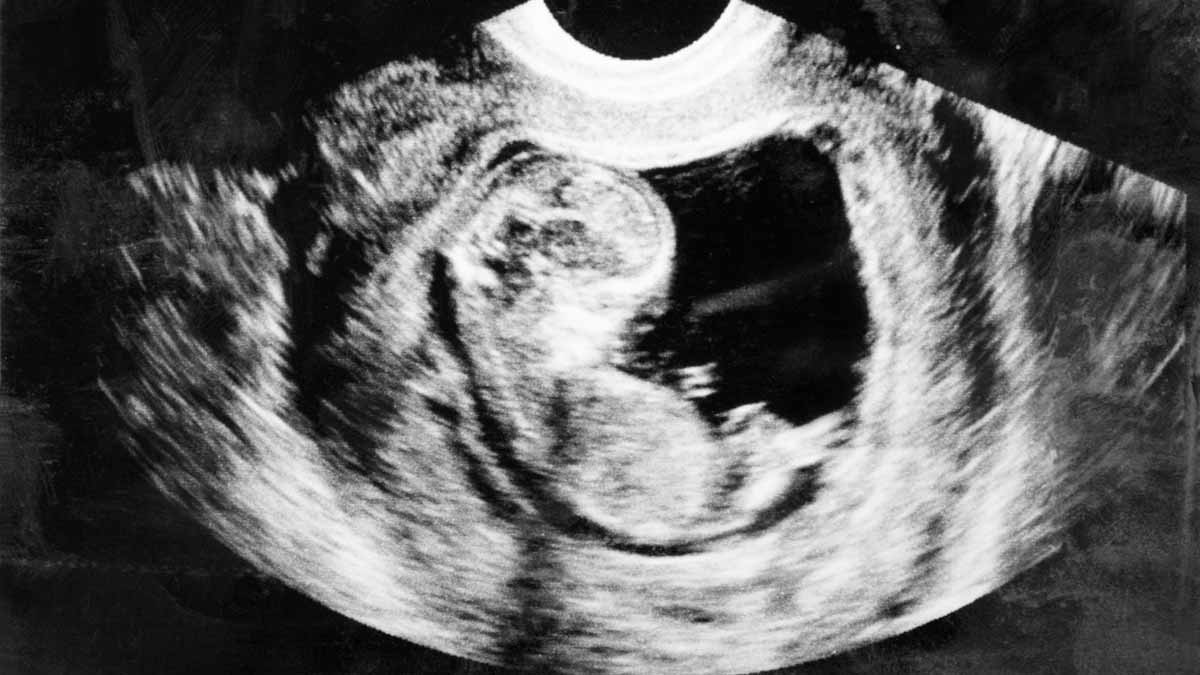 Legislatura de Indiana aprueba prohibiciones al aborto
