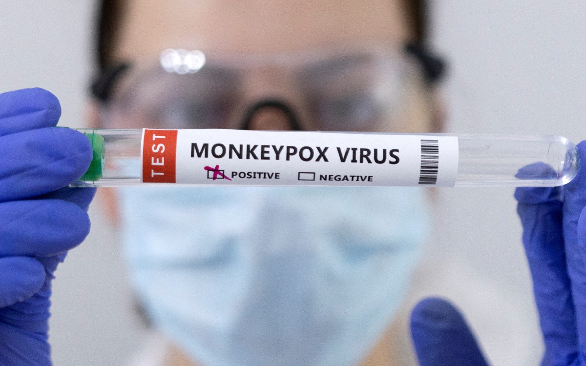 No más viruela del mono: la OMS busca renombrar a la enfermedad para evitar estigmas