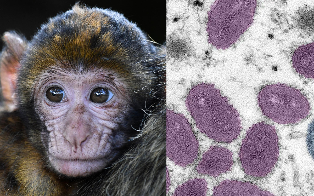 OMS lamenta agresiones a monos en Brasil por miedo a viruela símica | Video