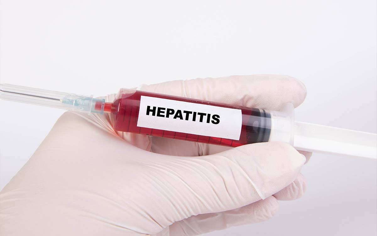 Identifican 303 casos de cepas del virus de hepatitis A en Europa