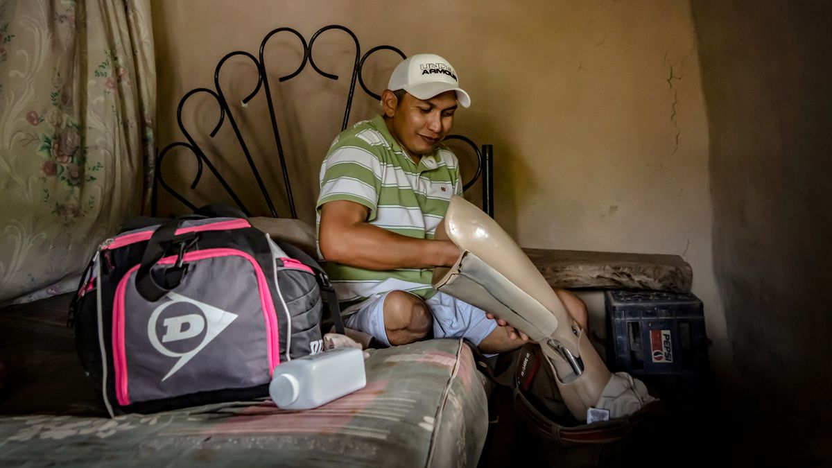 Los migrantes mutilados por ‘La Bestia’: en busca de una nueva vida