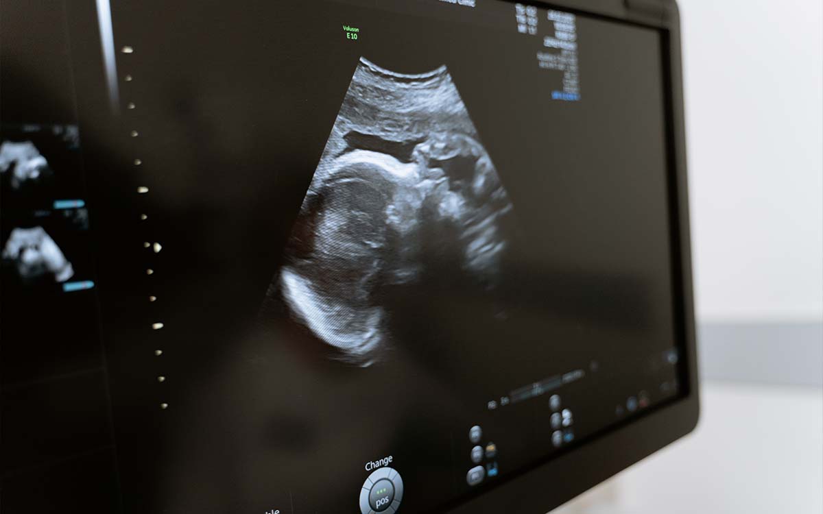 Suprema Corte de EU rechaza apelación sobre si fetos tienen derechos constitucionales