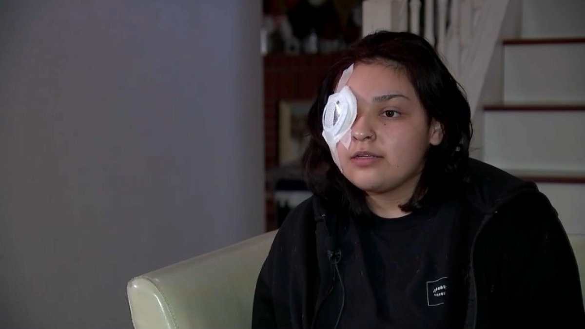 joven hispana pierde el ojo tras ser atacada por defender a adolescente con discapacidad en Antioch