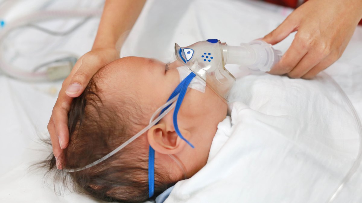 aumentan los casos de VSR en niños y bebés
