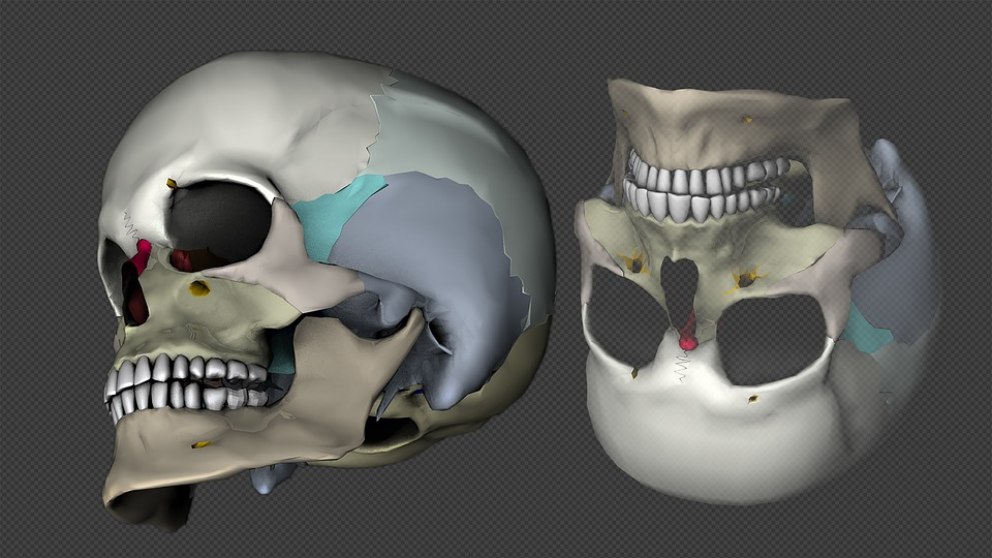 Cuáles son los huesos del cráneo