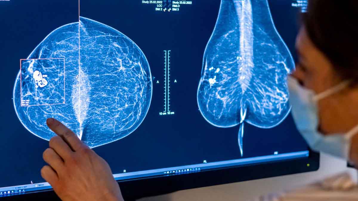 Nuevas reglas de la FDA para la realización de mamografías ayudarían a detectar el cáncer de seno