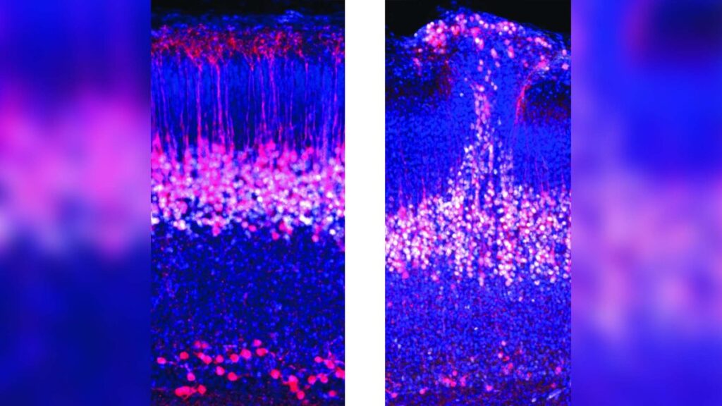 Impresionante hallazgo en el cerebro de los ratones podría aportar a la investigación sobre el autismo