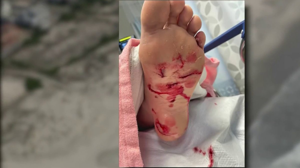 Quinceañera sufre mordida en playa de NJ consistente con una de tiburón