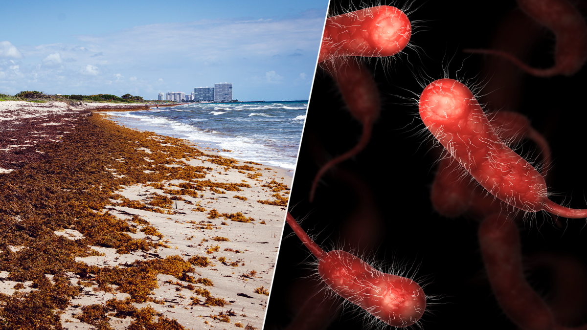 investigadores encuentran “altas cantidades” de bacterias carnívoras