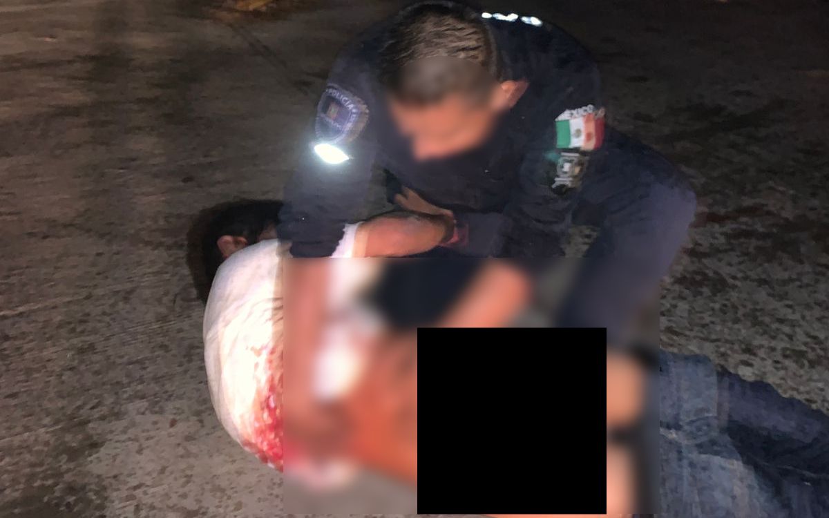 Policía de Morelos disparó contra joven; podría no volver a caminar