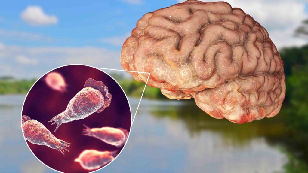 la ameba comecerebro mata a una persona en Georgia