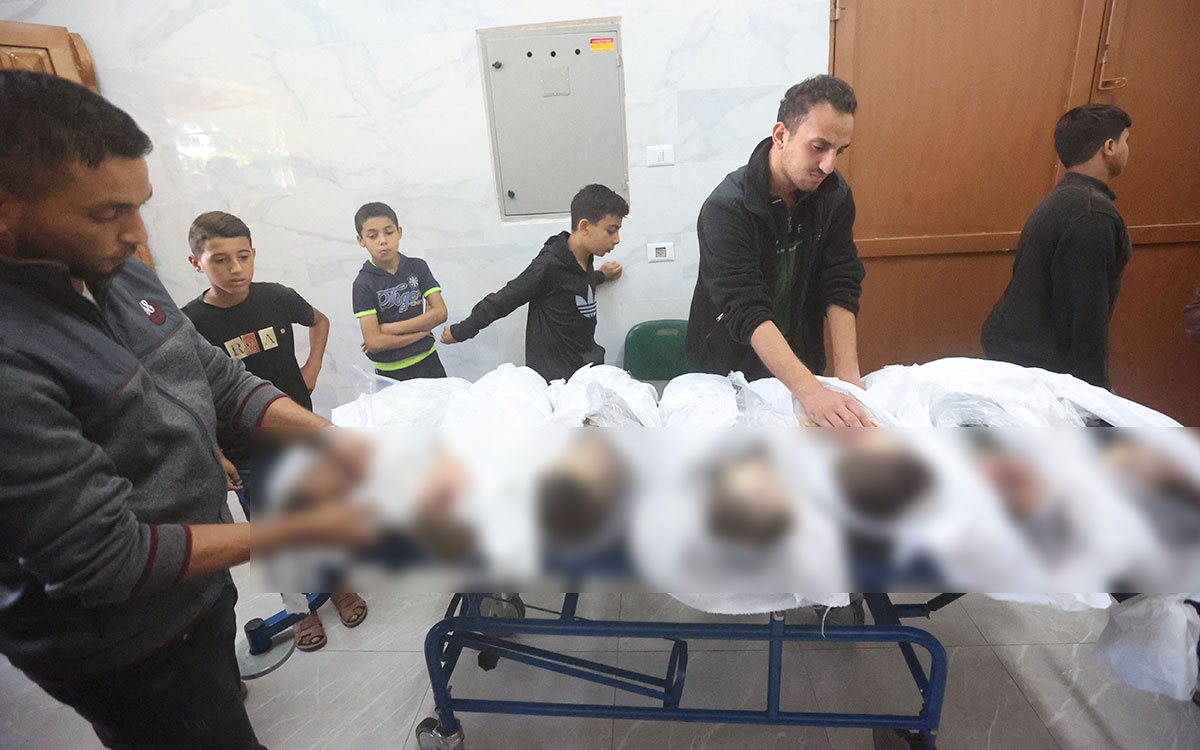 Hospitales de Gaza: sin anestesia y con pasillos abarrotados de heridos