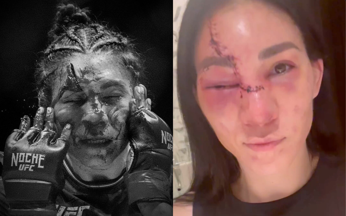 'Otro día en la oficina': Irene Aldana ya se recupera tras corte en pelea de UFC