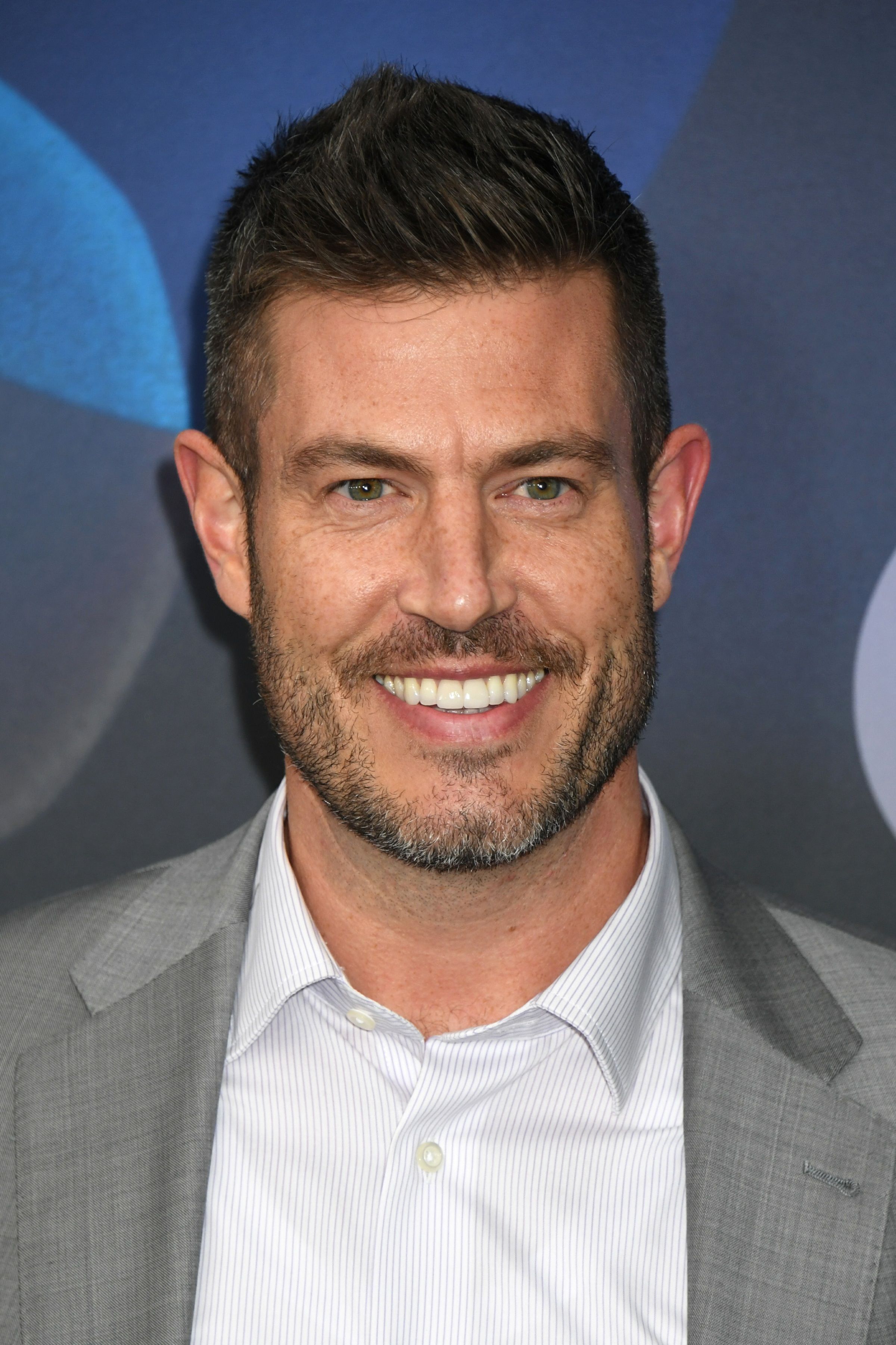 Tiro en la cabeza de Jesse Palmer