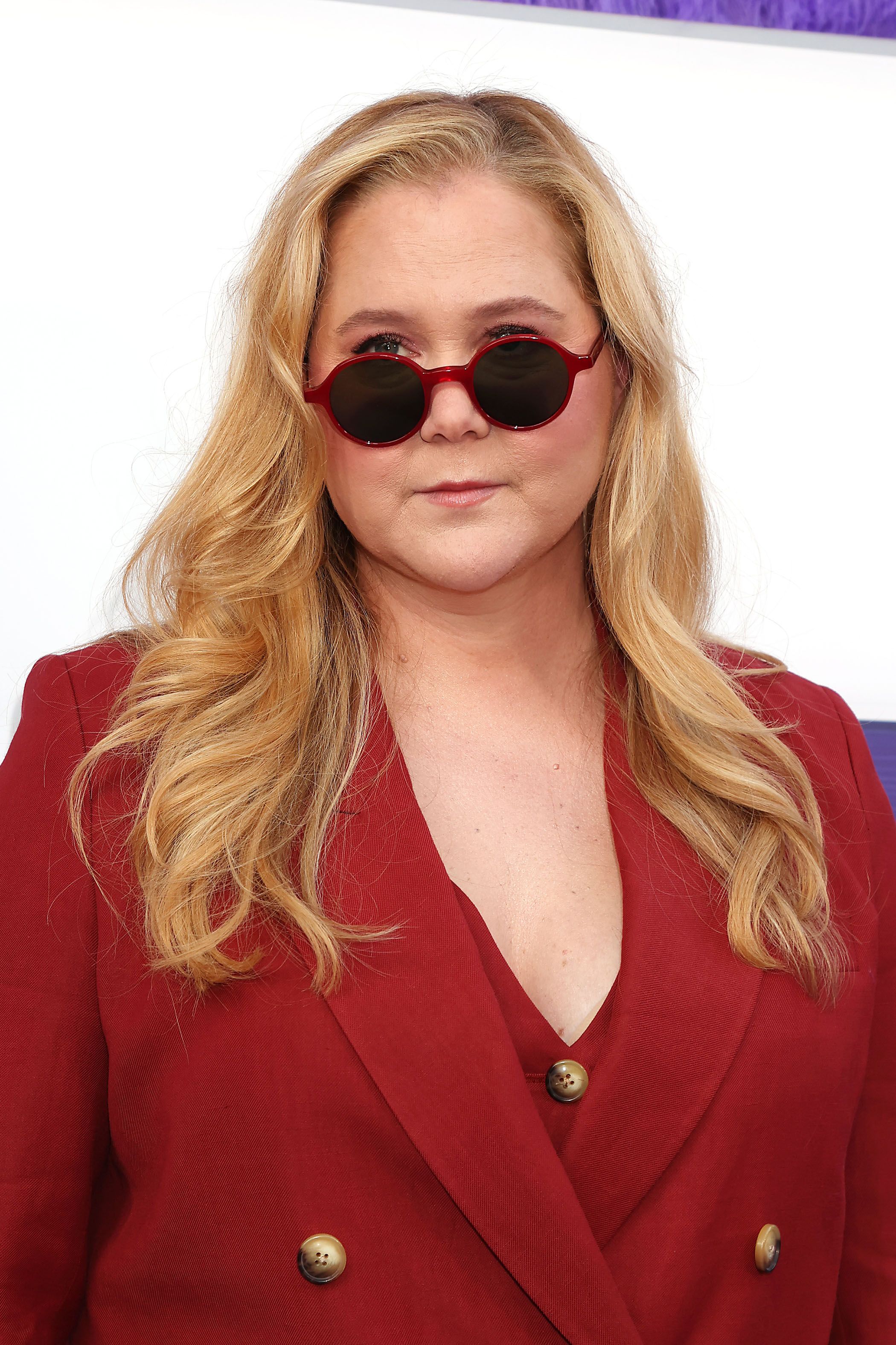 Tiro en la cabeza de Amy Schumer