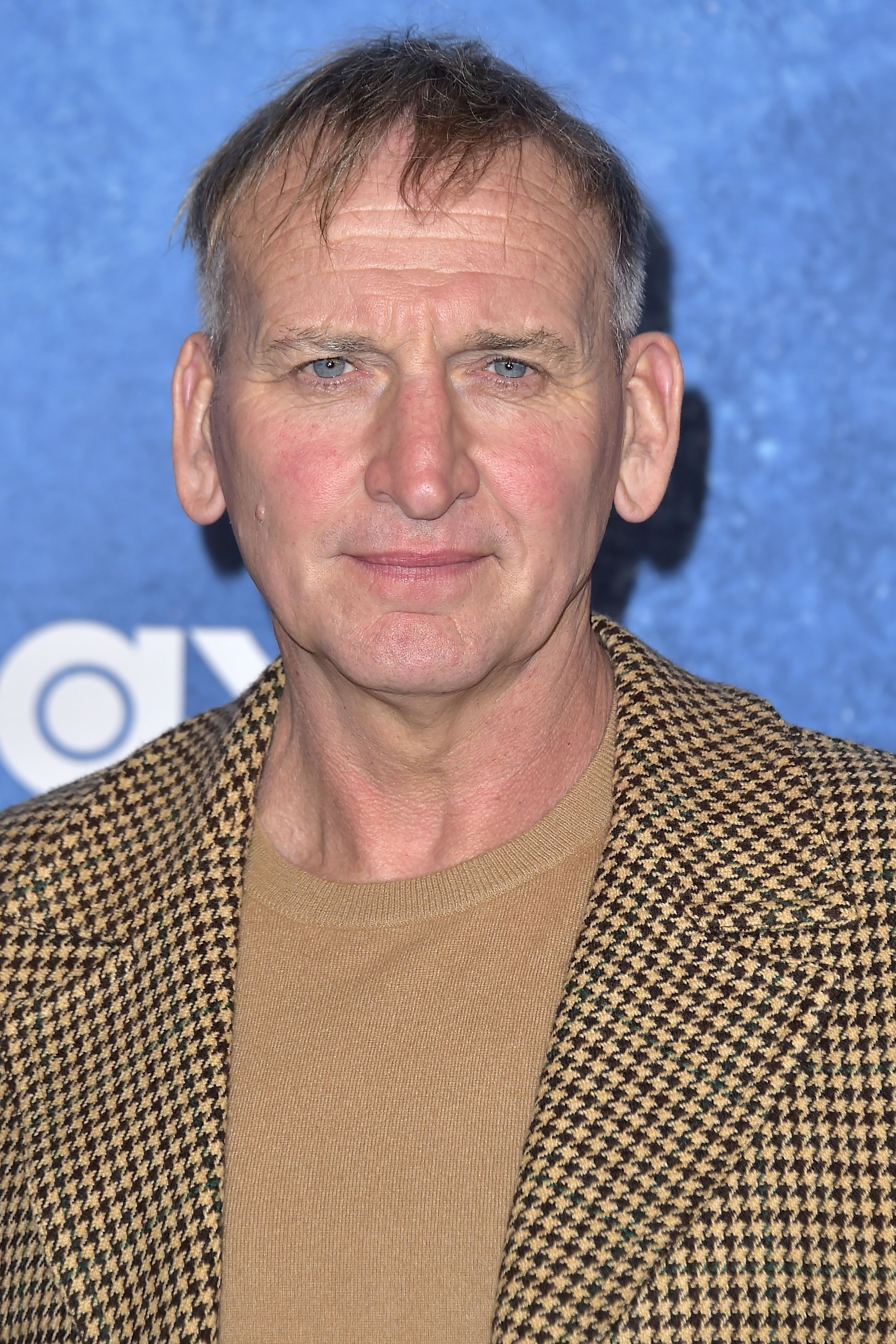 Tiro en la cabeza de Christopher Eccleston