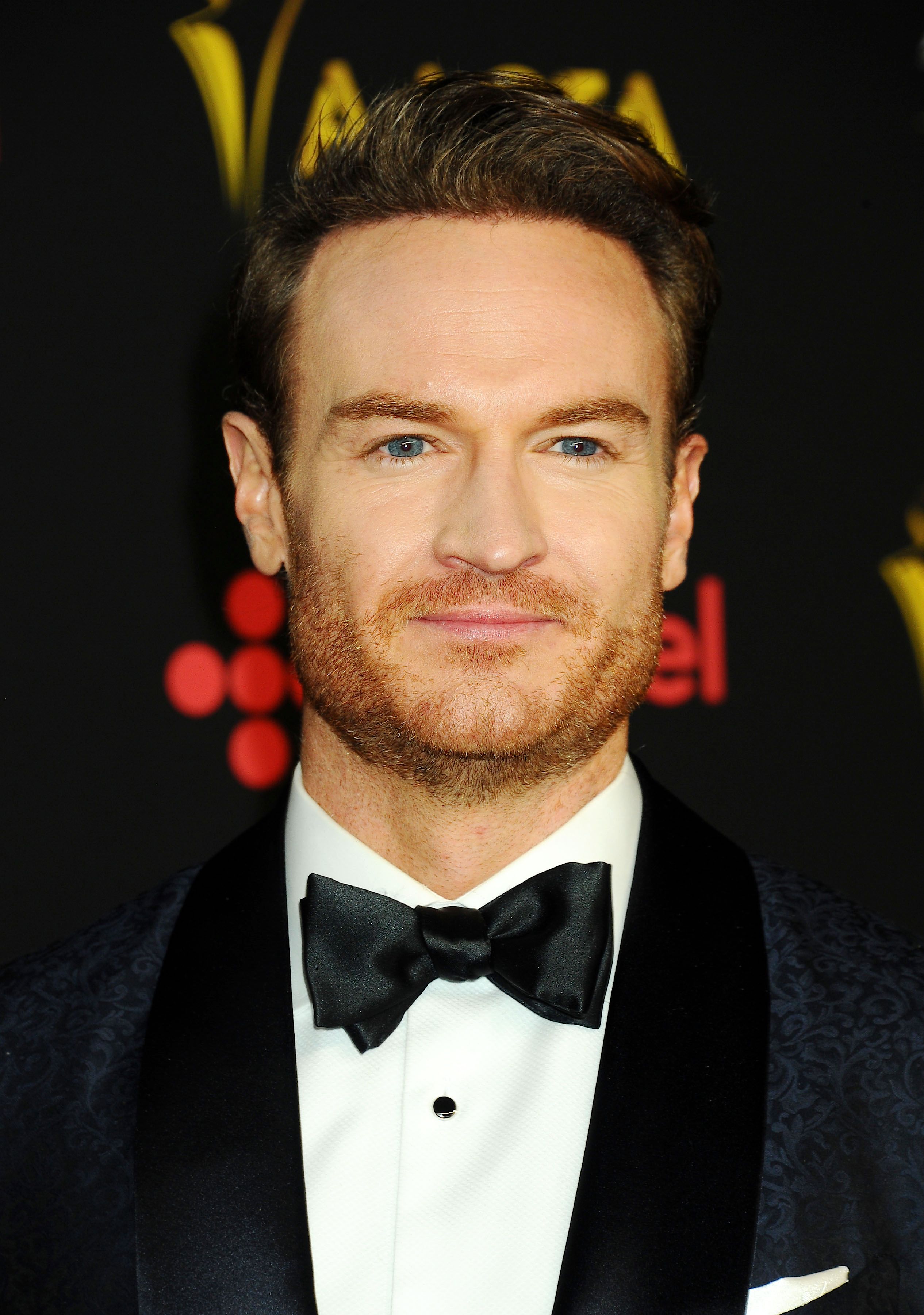 Tiro en la cabeza de Josh Lawson